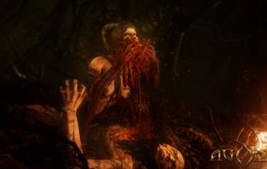 Agony